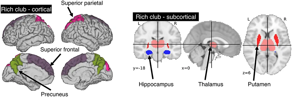 Rich-Club in the brain